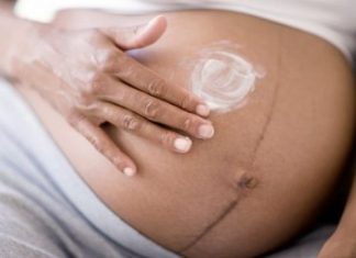Tips για να αποφύγεις τις ραγάδες στην εγκυμοσύνη