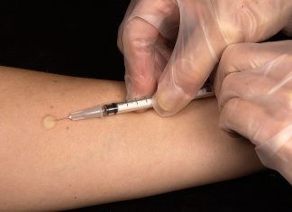 test Mantoux σε όλους τους μαθητές των νηπιαγωγείων του Δήμου Αλεξανδρούπολης