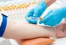 Το Υπουργείο Υγείας κλείνει τα αιμοληπτήρια Δικαίων και Μεταξάδων