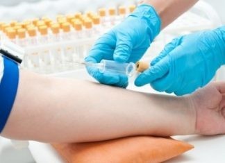 Το Υπουργείο Υγείας κλείνει τα αιμοληπτήρια Δικαίων και Μεταξάδων