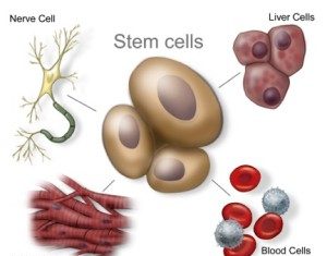 Θεραπεία με Βλαστοκύτταρα (stem cells)
