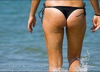 Έχεις κυτταρίτιδα; Πριν δοκιμάσεις οτιδήποτε πιες αυτό το ρόφημα!